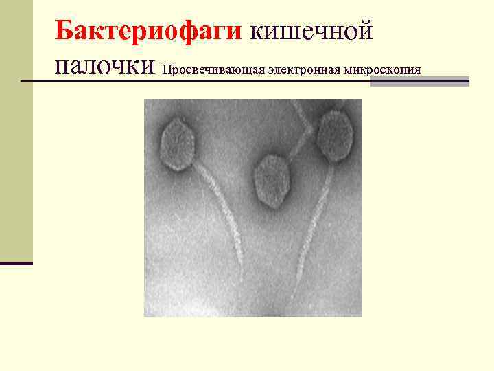 Бактериофаги кишечной палочки Просвечивающая электронная микроскопия 