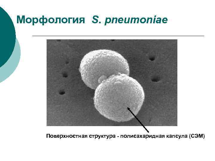 Морфология S. pneumoniae   Поверхностная структура - полисахаридная капсула (СЭМ) 