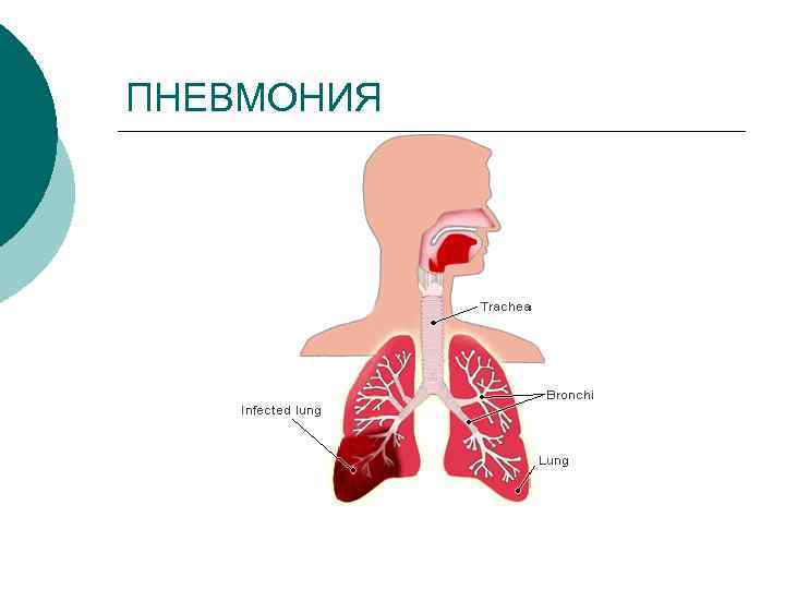 Пневмококк схема вакцинации