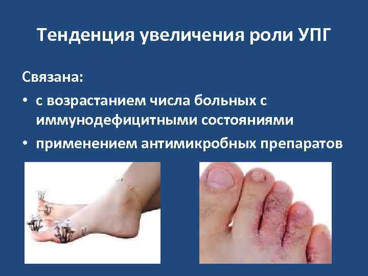  Тенденция увеличения роли УПГ Связана:  • с возрастанием числа больных с 