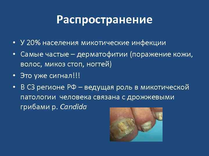   Распространение • У 20% населения микотические инфекции • Самые частые – дерматофитии