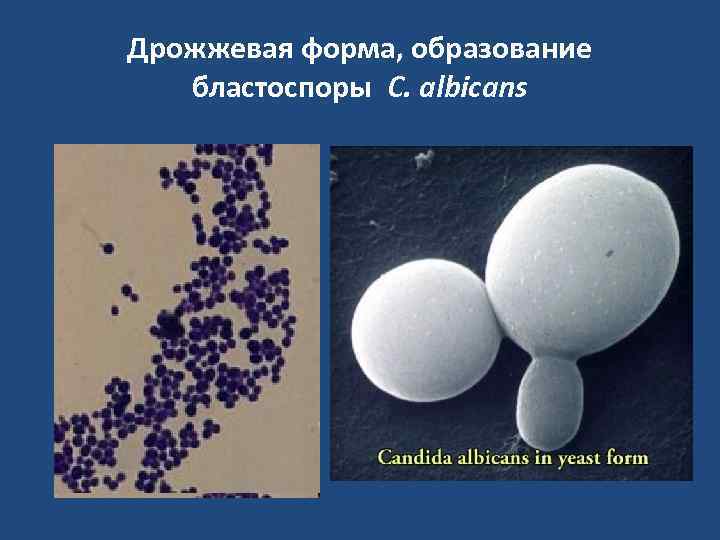 Дрожжевая форма, образование  бластоспоры C. albicans 