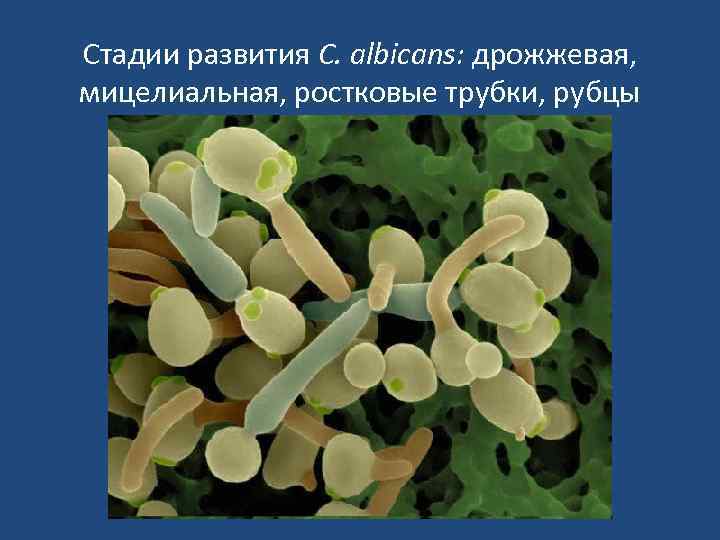 Стадии развития C. albicans: дрожжевая, мицелиальная, ростковые трубки, рубцы 