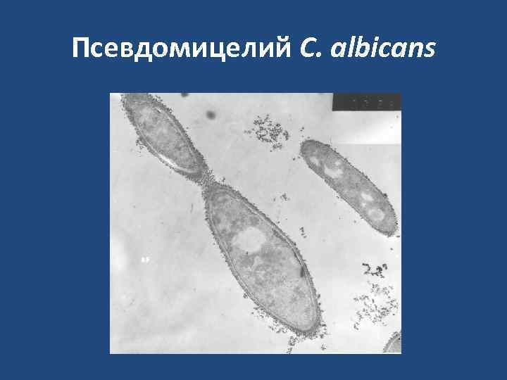 Псевдомицелий C. albicans 