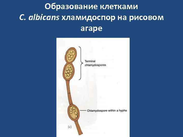   Образование клетками C. albicans хламидоспор на рисовом   агаре 