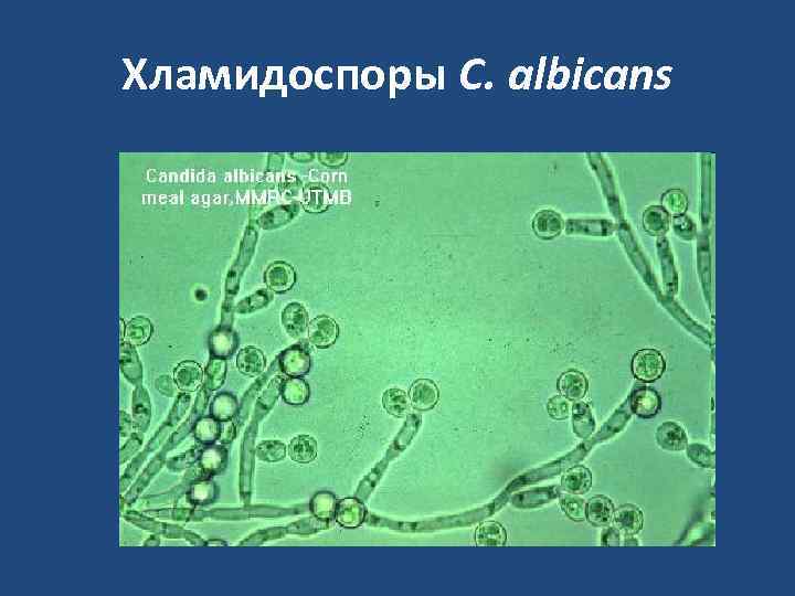 Микроскопические грибы презентация 2 класс