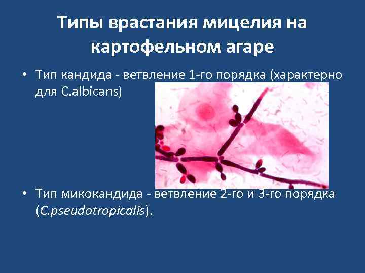  Типы врастания мицелия на   картофельном агаре • Тип кандида - ветвление