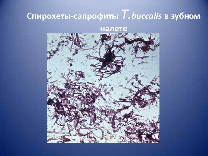 Спирохеты-cапрофиты T. buccalis в зубном    налете 