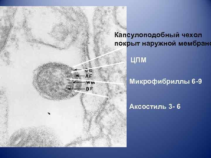 Капсулоподобный чехол покрыт наружной мембрано ЦПМ Микрофибриллы 6 -9 Аксостиль 3 - 6 