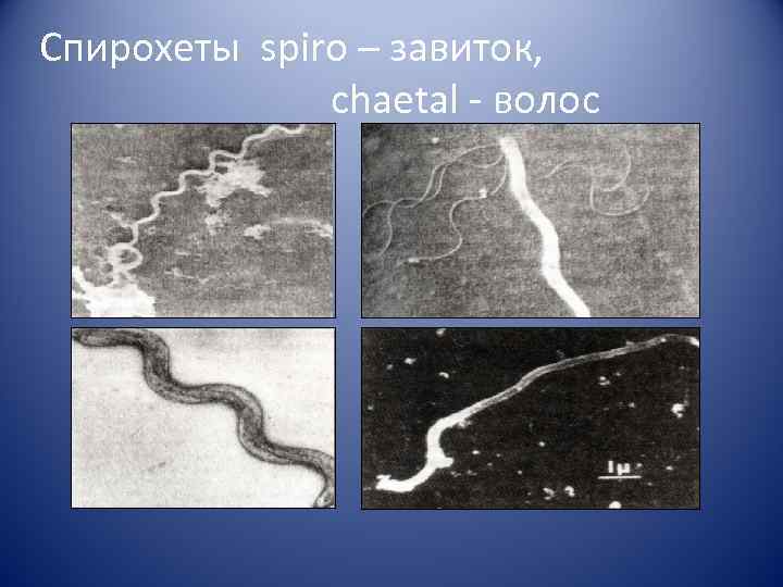 Спирохеты spiro – завиток,    chaetal - волос 