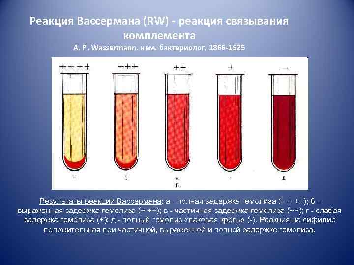   Реакция Вассермана (RW) - реакция связывания    комплемента  