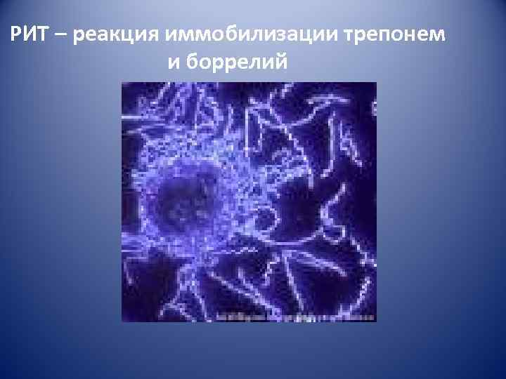 РИТ – реакция иммобилизации трепонем    и боррелий 