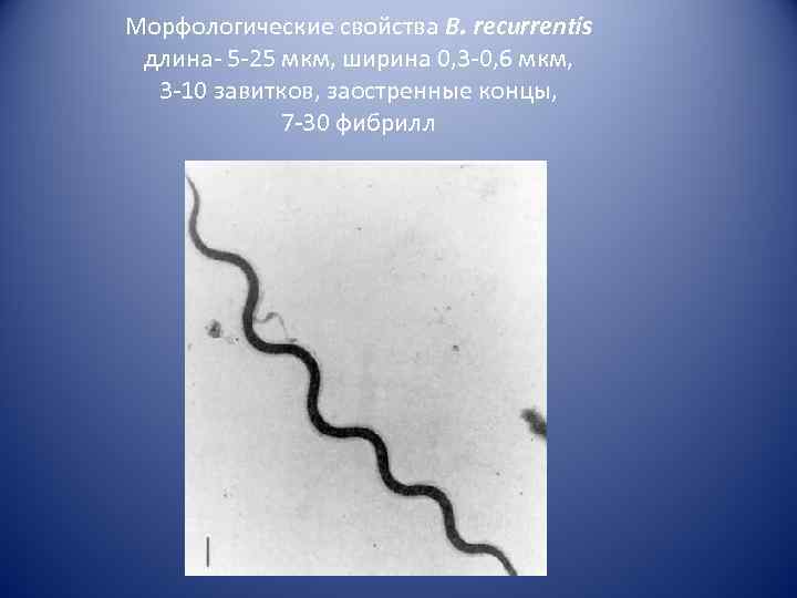 Морфологические свойства B. recurrentis длина- 5 -25 мкм, ширина 0, 3 -0, 6 мкм,