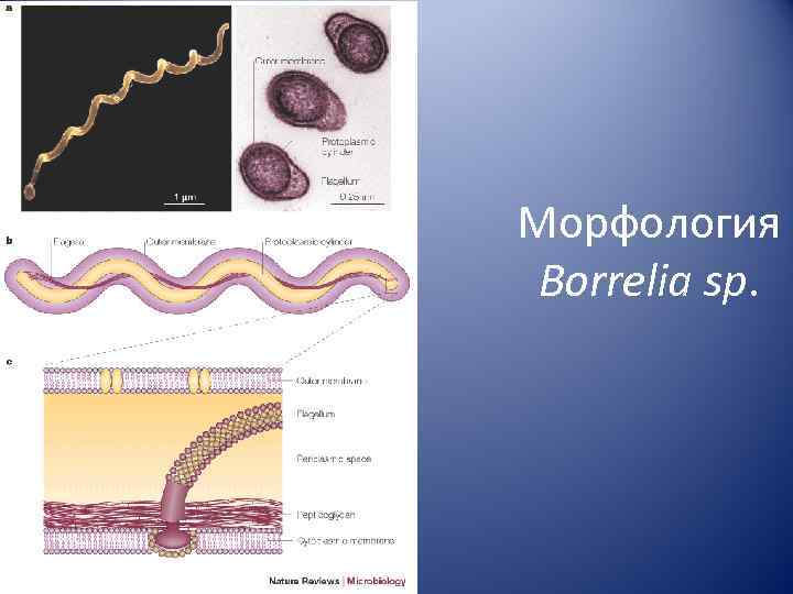 Морфология Borrelia sp. 