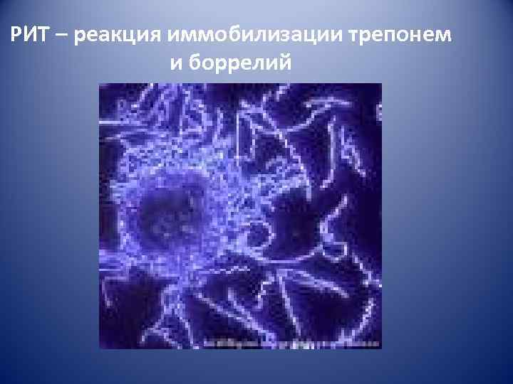 РИТ – реакция иммобилизации трепонем    и боррелий 
