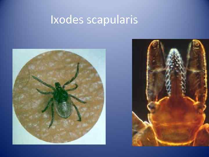 Ixodes scapularis 