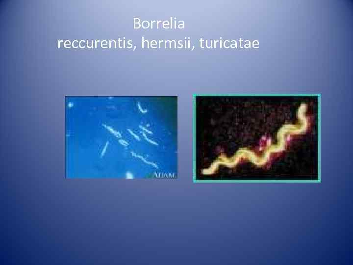   Borrelia reccurentis, hermsii, turicatae 