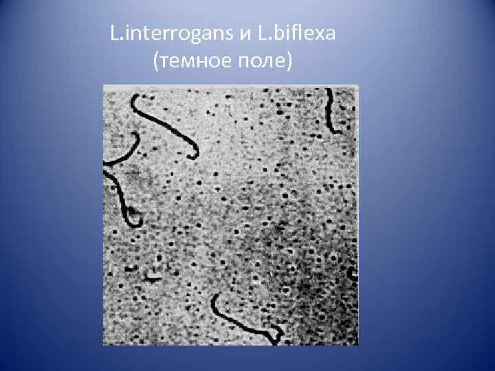 L. interrogans и L. biflexa (темное поле) 