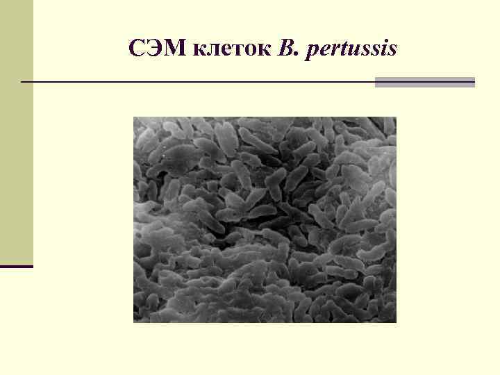 СЭМ клеток B. pertussis 