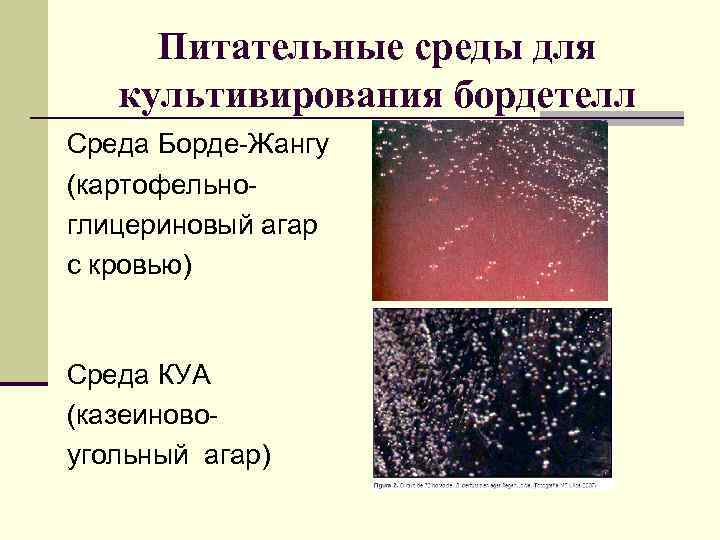  Питательные среды для  культивирования бордетелл Среда Борде-Жангу (картофельно- глицериновый агар с кровью)