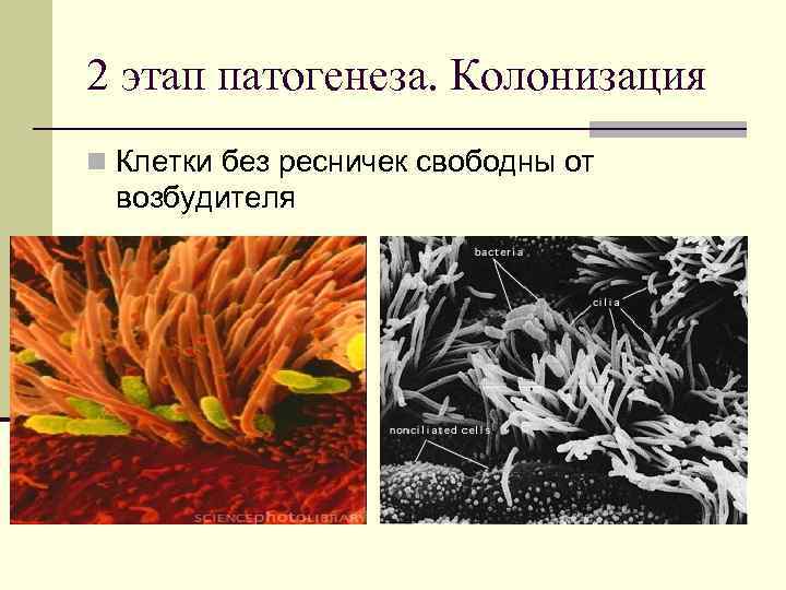 2 этап патогенеза. Колонизация n Клетки без ресничек свободны от возбудителя 