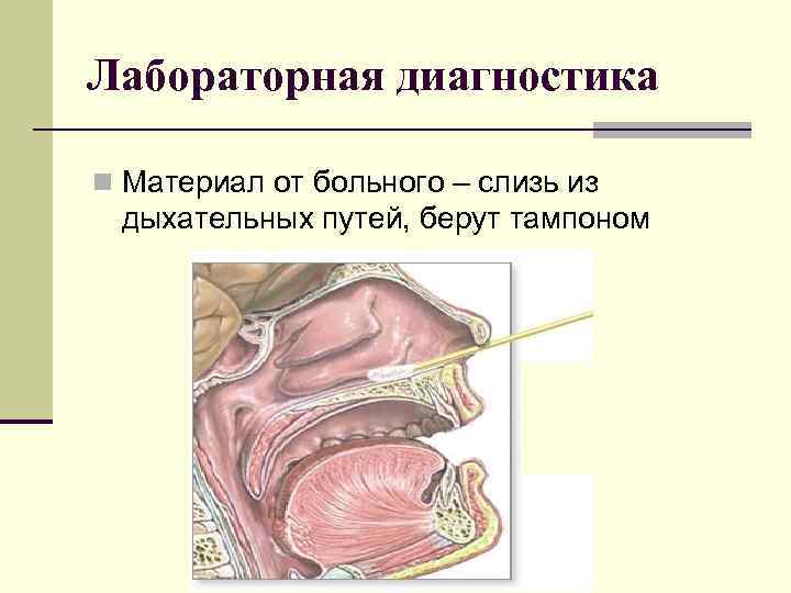 Лабораторная диагностика n Материал от больного – слизь из дыхательных путей, берут тампоном 