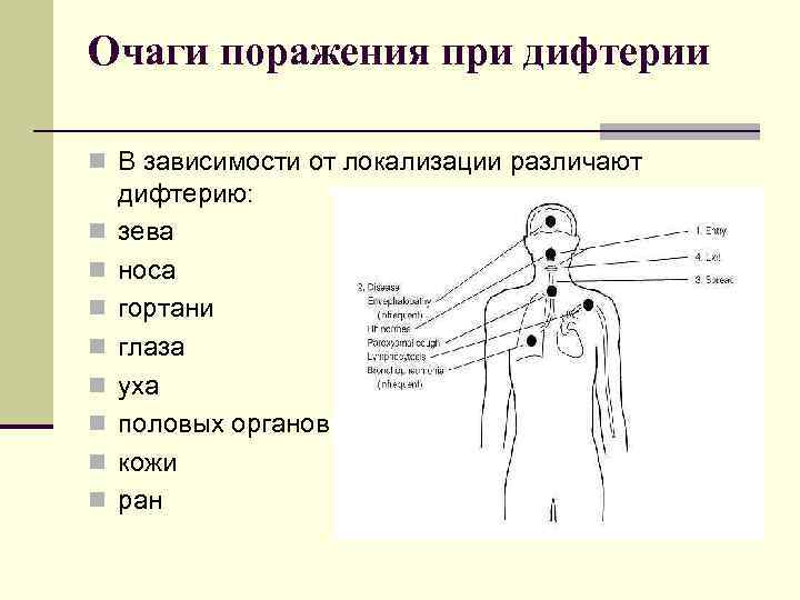 Очаги поражения при дифтерии n В зависимости от локализации различают дифтерию: n  зева