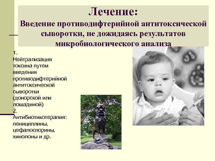      Лечение:  Введение противодифтерийной антитоксической  сыворотки, не дожидаясь