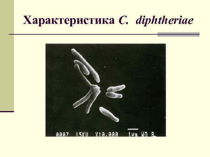 Характеристика C. diphtheriae 