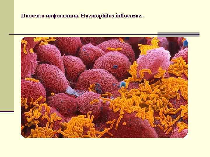 Палочка инфлюэнцы. Haemophilus influenzae. . 