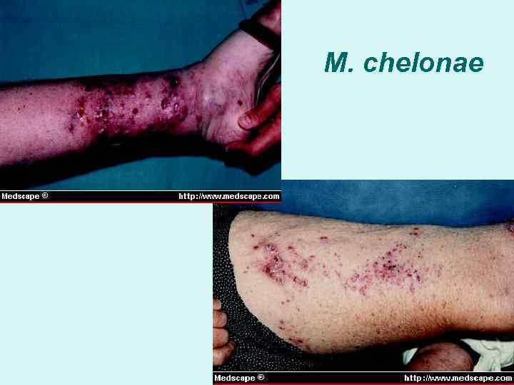 M. chelonae 