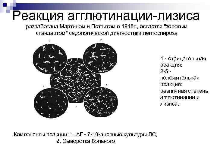 Реакция агглютинации-лизиса разработана Мартином и Петтитом в 1918 г , остается 
