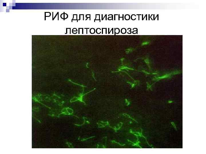 РИФ для диагностики  лептоспироза 