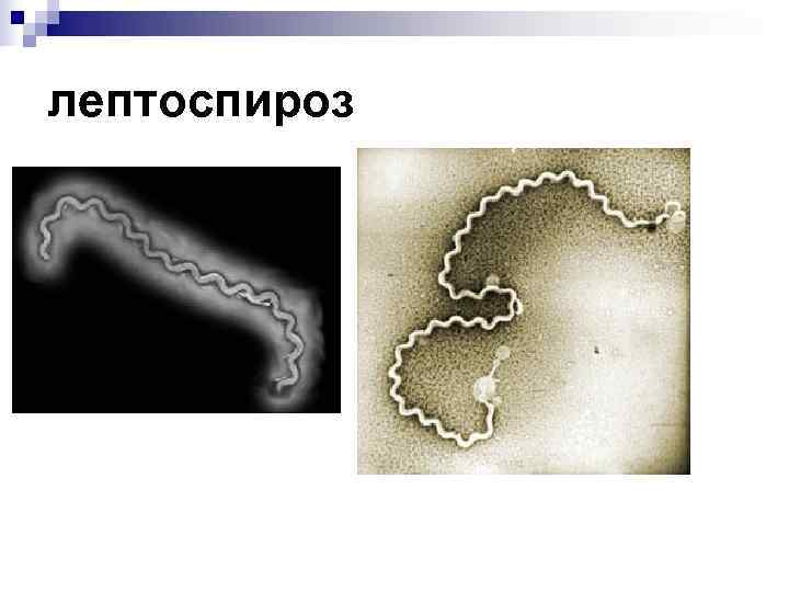 лептоспироз 