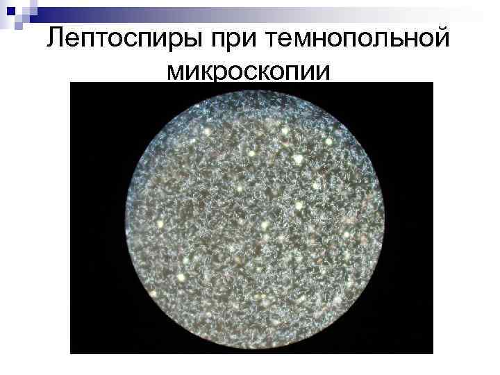 Лептоспиры при темнопольной   микроскопии 