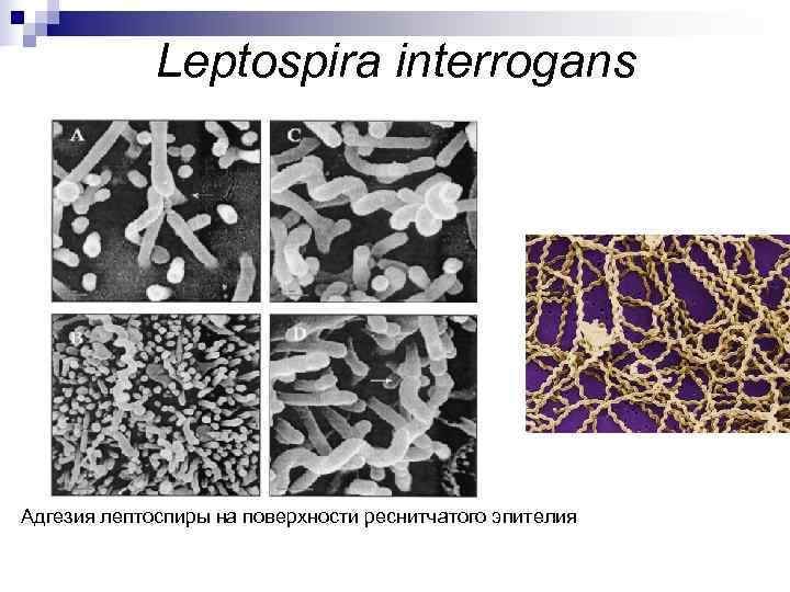    Leptospira interrogans Адгезия лептоспиры на поверхности реснитчатого эпителия 