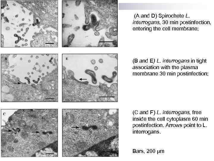  (A and D) Spirochete L. interrogans, 30 min postinfection, entering the cell membrane;