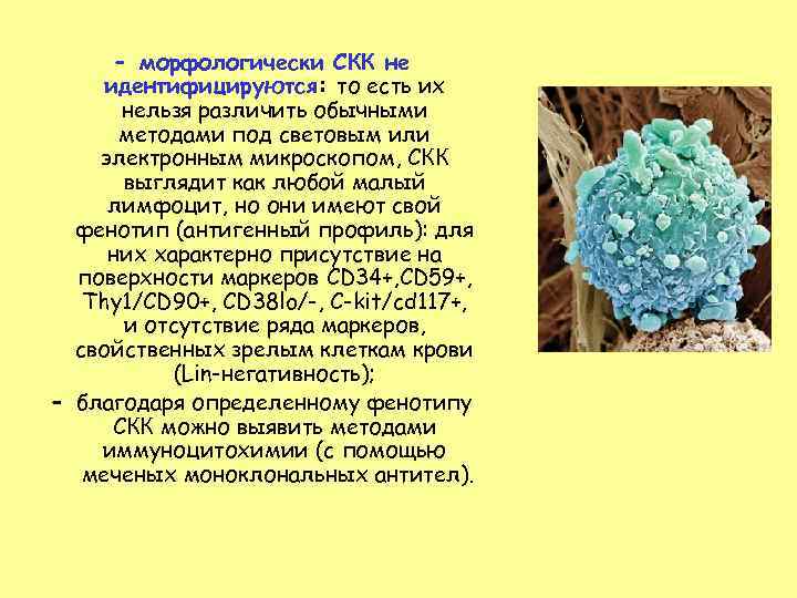  – морфологически СКК не идентифицируются: то есть их  нельзя различить обычными 
