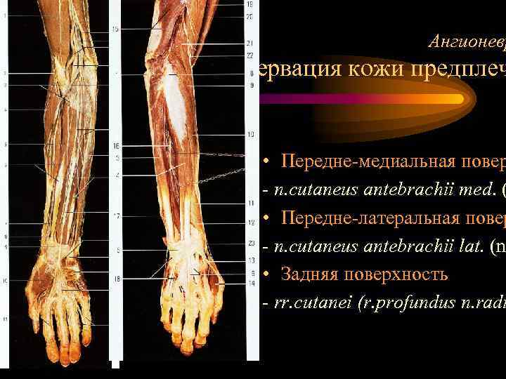 Ангионевр Иннервация кожи предплеч • Передне-медиальная повер - n. cutaneus antebrachii med. ( •