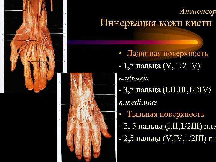Ангионевр Иннервация кожи кисти • Ладонная поверхность - 1, 5 пальца (V, 1/2 IV)