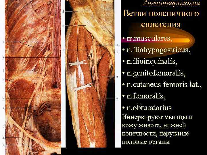 Ангионеврология Ветви поясничного сплетения • rr. musculares, • n. iliohypogastricus, • n. ilioinquinalis, •