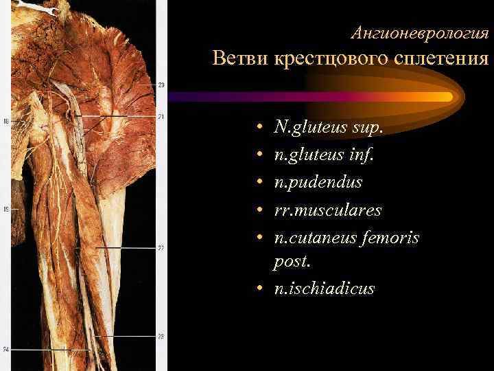 Ангионеврология Ветви крестцового сплетения • • • N. gluteus sup. n. gluteus inf. n.