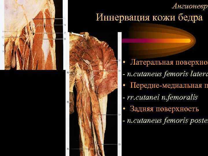 Ангионевро Иннервация кожи бедра • Латеральная поверхнос - n. cutaneus femoris latera • Передне-медиальная