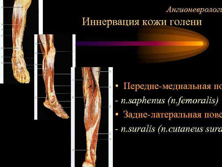 Ангионеврологи Иннервация кожи голени • Передне-медиальная по - n. saphenus (n. femoralis) • Задне-латеральная