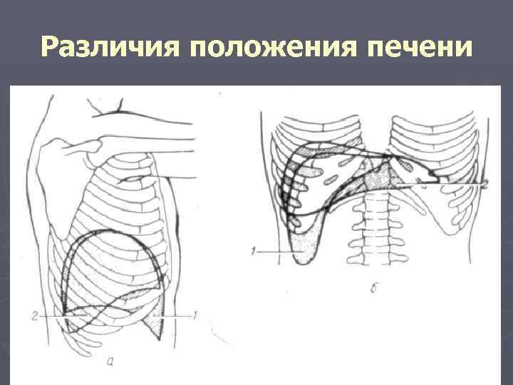 Различия положения печени 