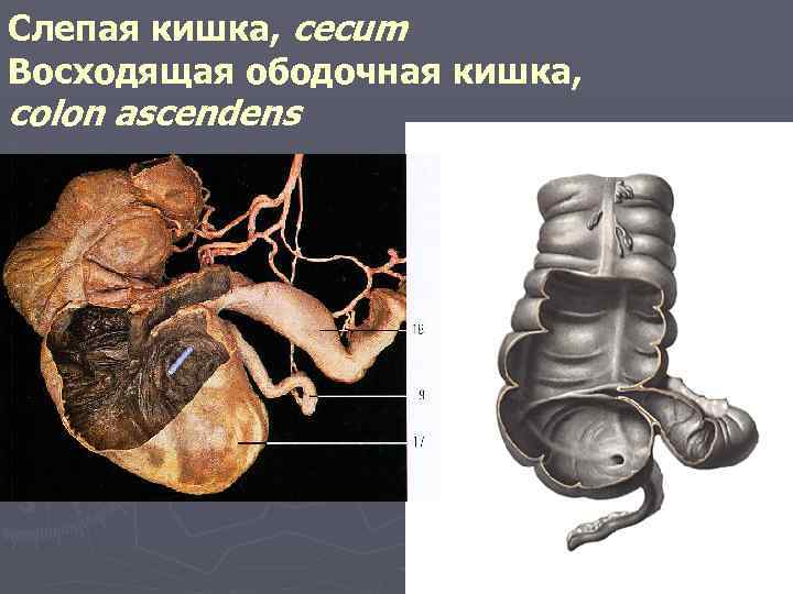 Слепая кишка, cecum Восходящая ободочная кишка, colon ascendens 