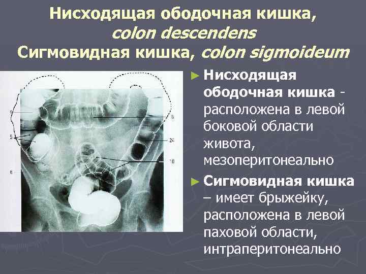 Нисходящая ободочная кишка, colon descendens Cигмовидная кишка, colon sigmoideum ► Нисходящая ободочная кишка расположена