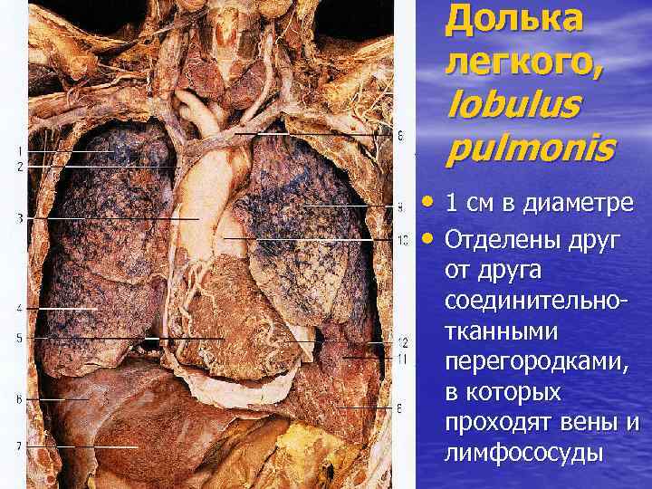 Долька легкого, lobulus pulmonis • 1 см в диаметре • Отделены друг от друга