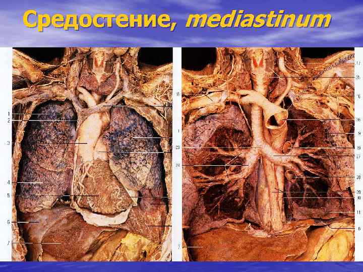 Средостение, mediastinum 
