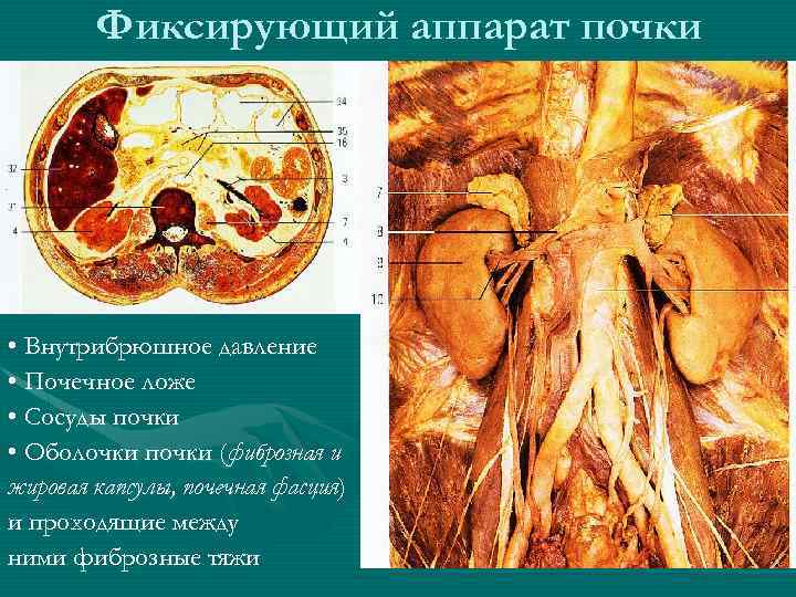 Фиксирующий аппарат почки • Внутрибрюшное давление • Почечное ложе • Сосуды почки • Оболочки